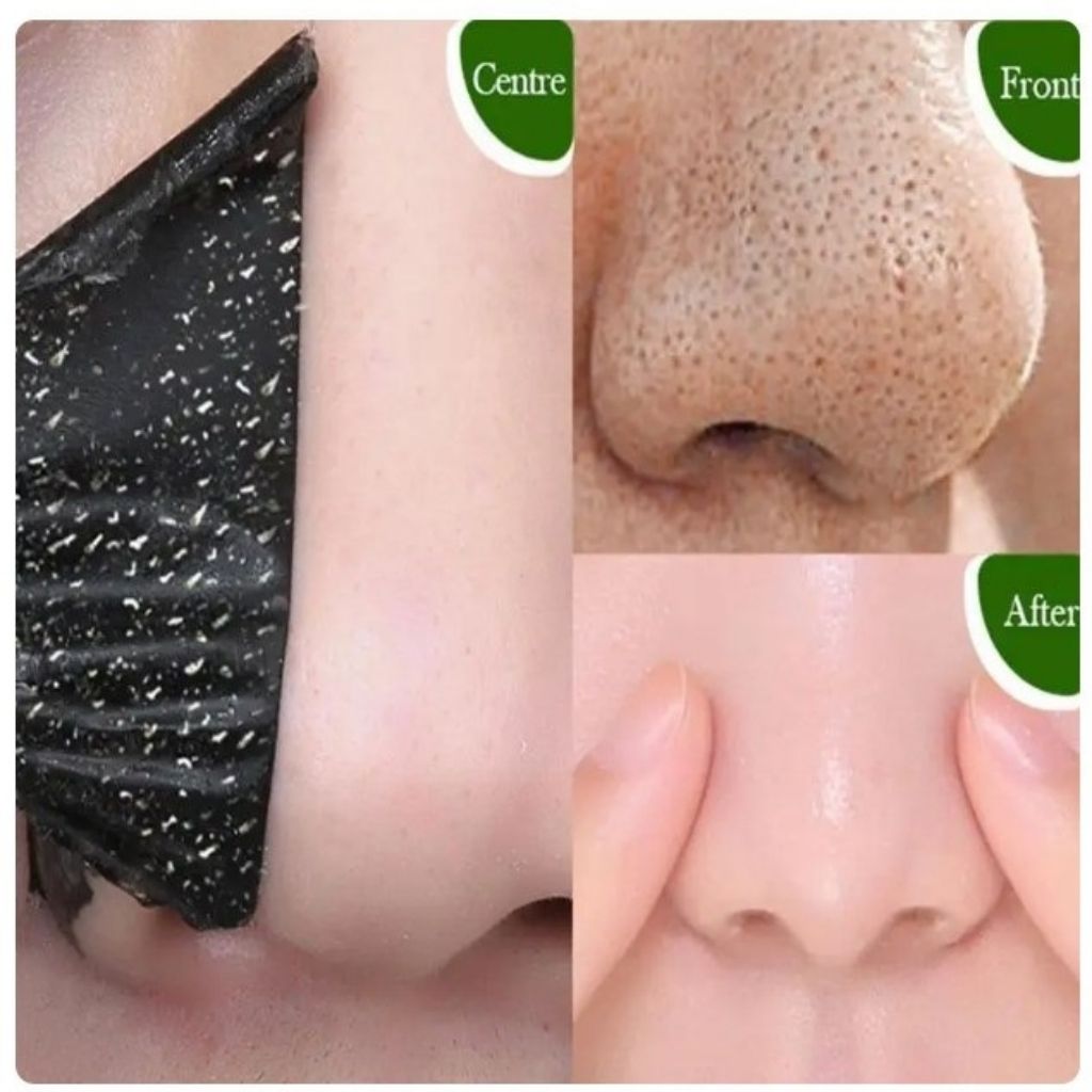 Crema Facial Exfoliante de Carbón