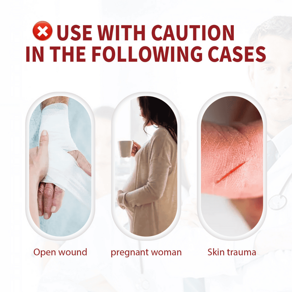 Varicose veins crema para varices