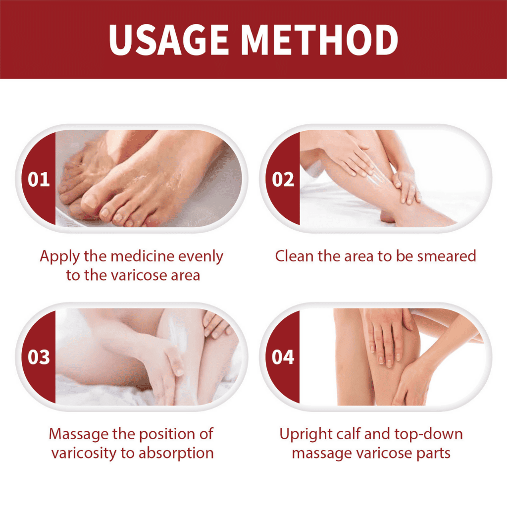 Varicose veins crema para varices