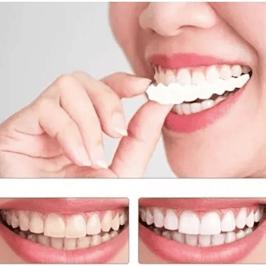 CARILLAS DE DIENTES POSTIZOS DE SONRISA